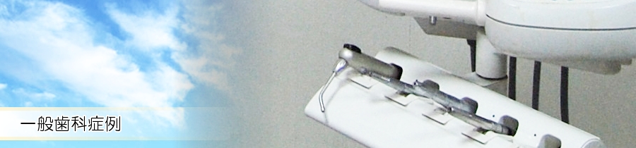 一般歯科症例